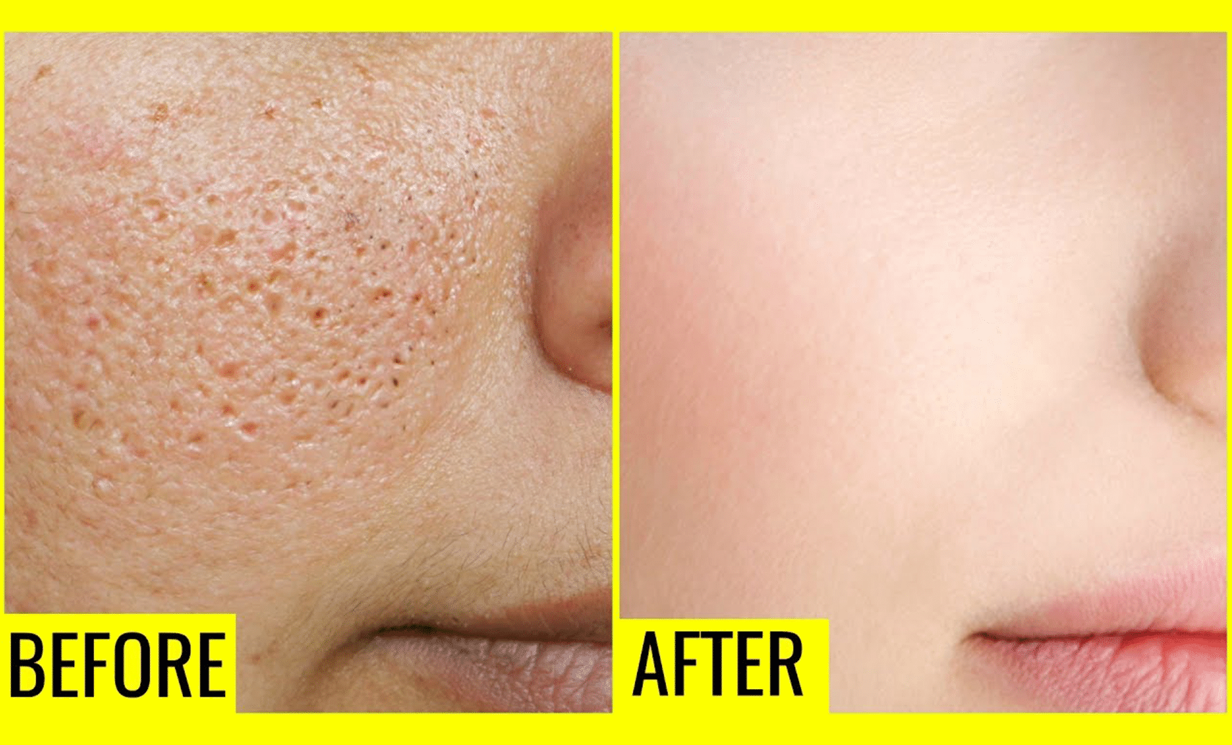how to shrink large pores